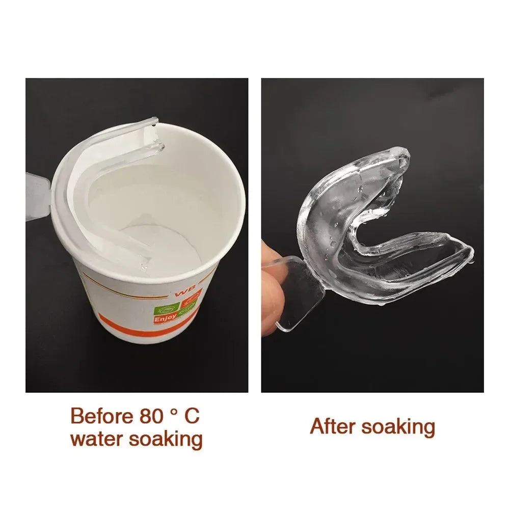 Mouthguard for Teeth Grinding & Snoring: The Ultimate Multi-Purpose Protector.