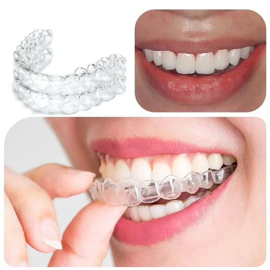 Mouthguard for Teeth Grinding & Snoring: The Ultimate Multi-Purpose Protector.