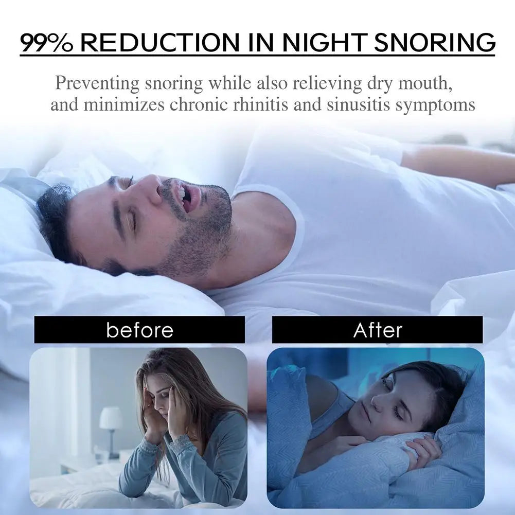 Mouth Orthosis Sleep Tape: Your Simple Path to Silent Sleep.