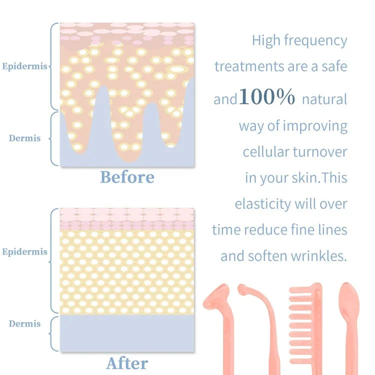 4-in-1 High Frequency Facial Wand – Portable Skin Therapy for Acne & Anti-Aging