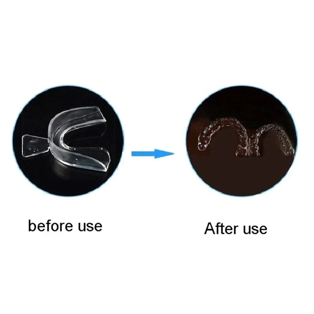 Mouthguard for Teeth Grinding & Snoring: The Ultimate Multi-Purpose Protector.